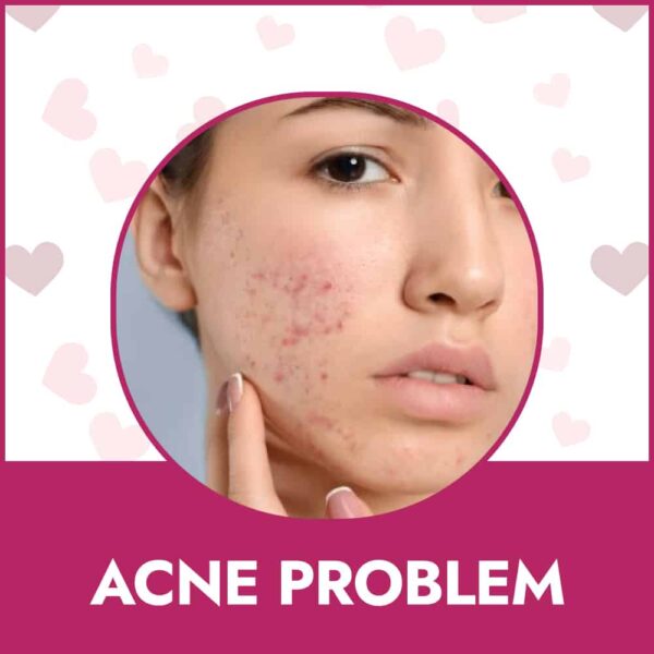 targeted treatment acne problem app