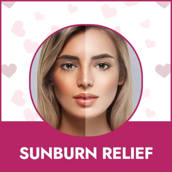 targeted treatment sunburn relief app